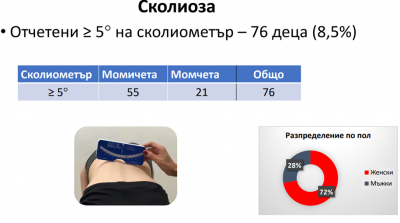 Скрининг за гръбначни изкривявания, плоскостъпие и скъсени ахилеси